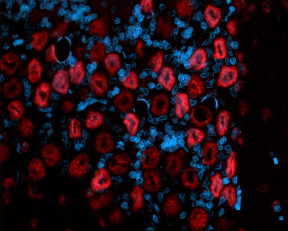 15-brain-ihc-if-cy5dapi.jpg