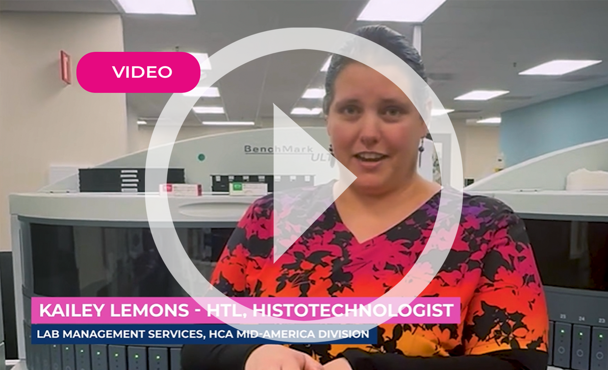 Why HCA Mid-America Division only uses KT slides in their lab.