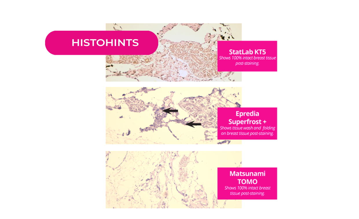 Adhesion slides: Stick with any, or pick the right one?