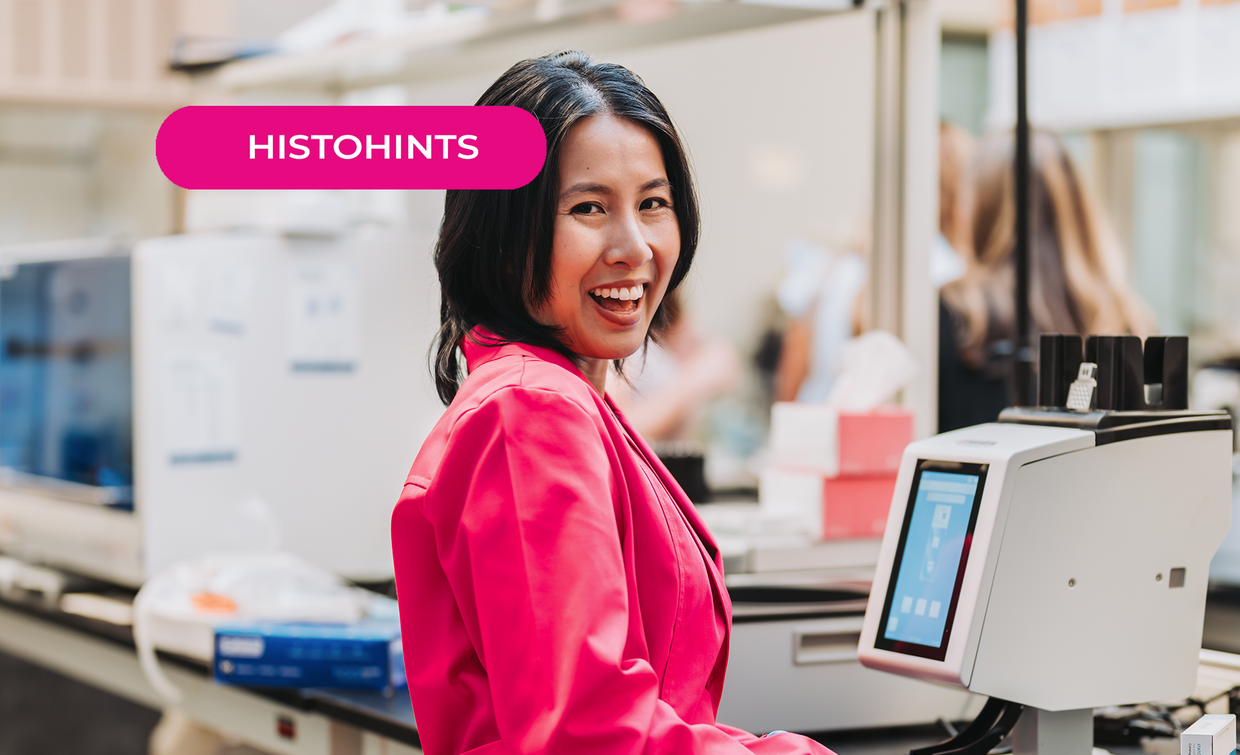 Battle of the printers: Thermal transfer or laser printer?