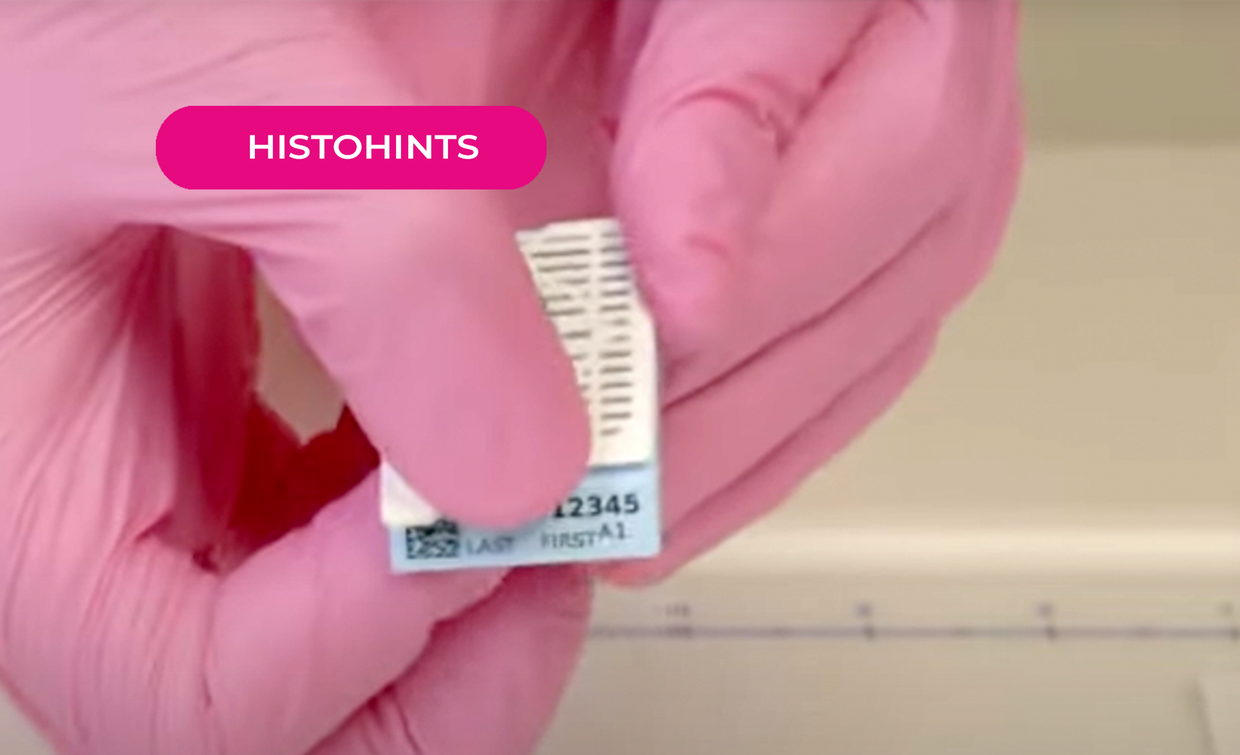  Histology Hacks: Best practices for cassette success!