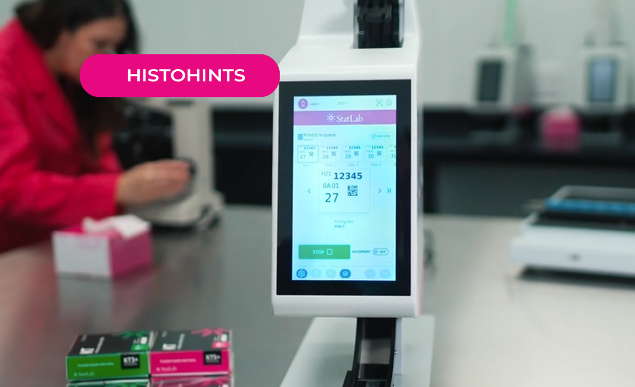 Upgrading your single hopper printer with confidence: Simplicity is SMART.