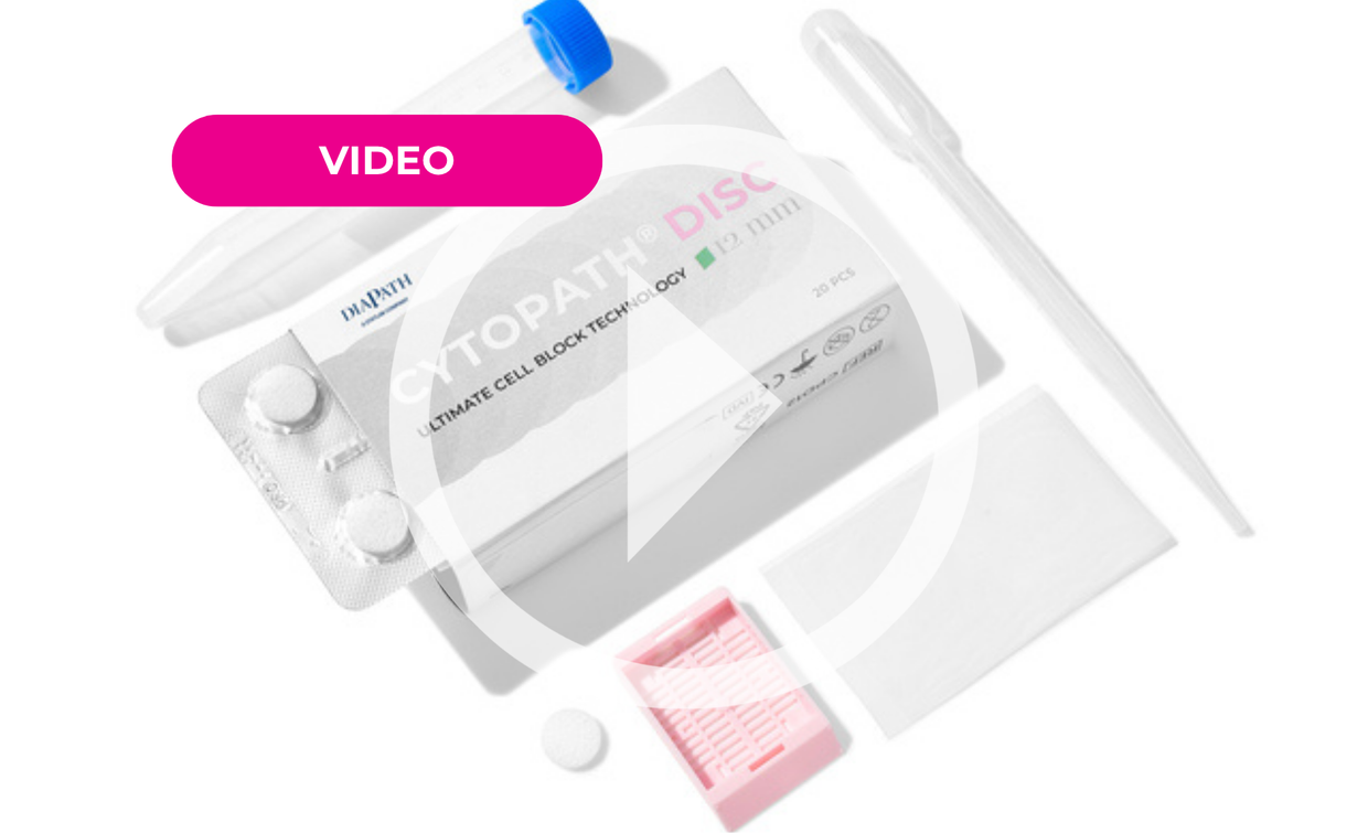 CytoPath Disc - IFU Video