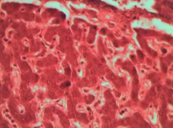 StatLab HCS Australian Antigen Control Slides, Adhesive, 25 slides/box