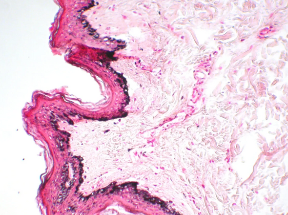 StatLab HCS Melanin Control Slides, adhesive slide. 100 slides / box