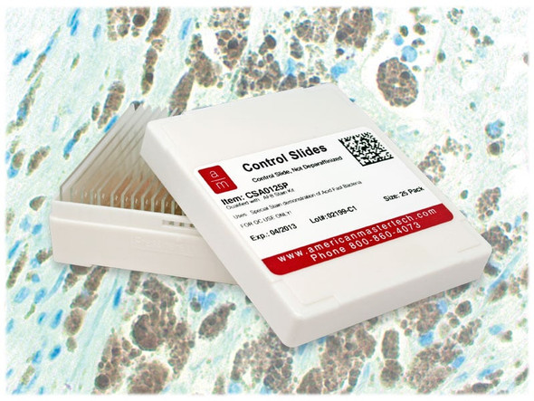 Melanoma S-100 Controls/25