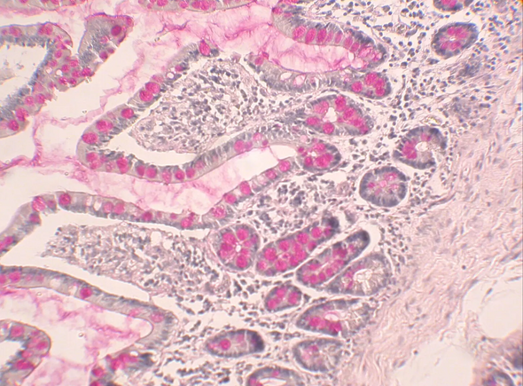 StatLab HCS Mucicarmine Control Slides, adhesive slide