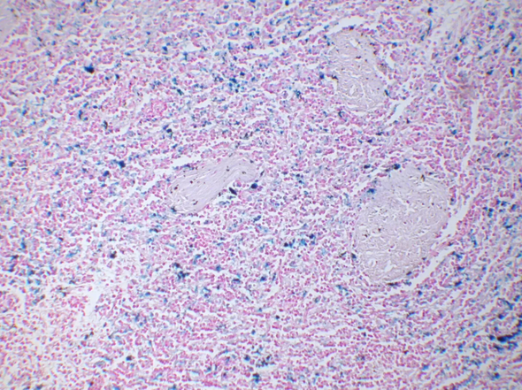 StatLab HCS Iron Control Slides, non-adhesive slide