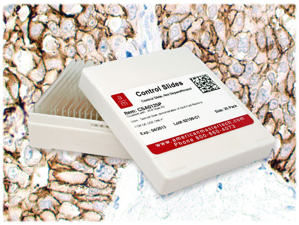 Breast Carc. c-erbB-2+ /Pk(25)