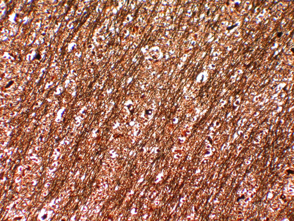 StatLab HCS Bodian's for Nerve Fibers Control Slides, adhesive slide. 25 slides / box