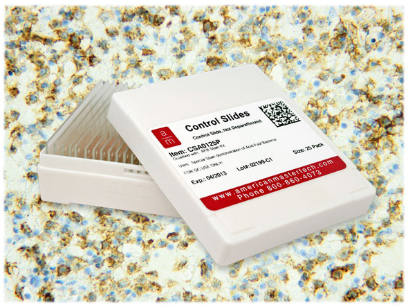 Hairy Cell Leukemia IHC Control Slides