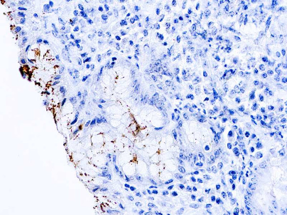 H. Pylori (P), 6mL (Manual Use)