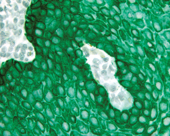 Green AP Chromogen, Ultra High Def