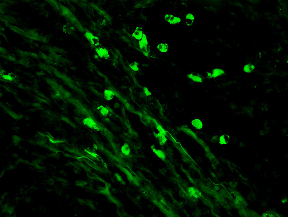 IgM Antibody with FITC tag 1ml