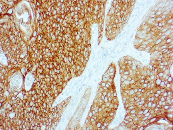 Cytokeratin 5/6, Clone D5/16B4, (Manual Use)