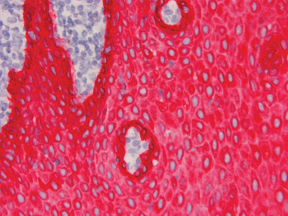 Red HRP Chromogen, Ultra High Def