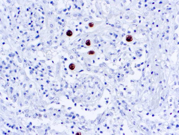 Manual Cytomegalovirus (CMV Cocktail) ASR