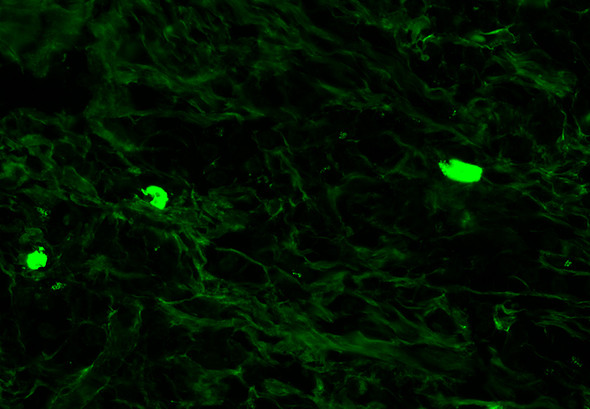 IgG Antibody with FITC tag 1ml