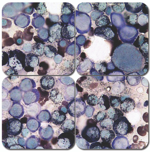 Sudan Black B Histochemical Stain Kit
