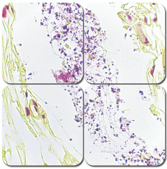 Brown & Brenn Modified Stain Kit