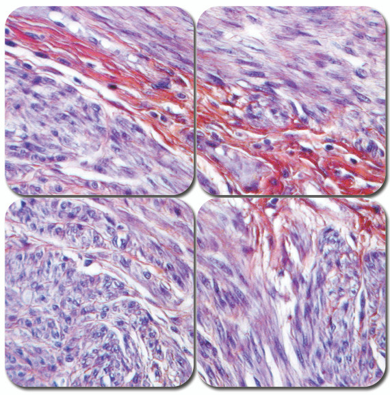 PTAH Stain Kit - Microwave