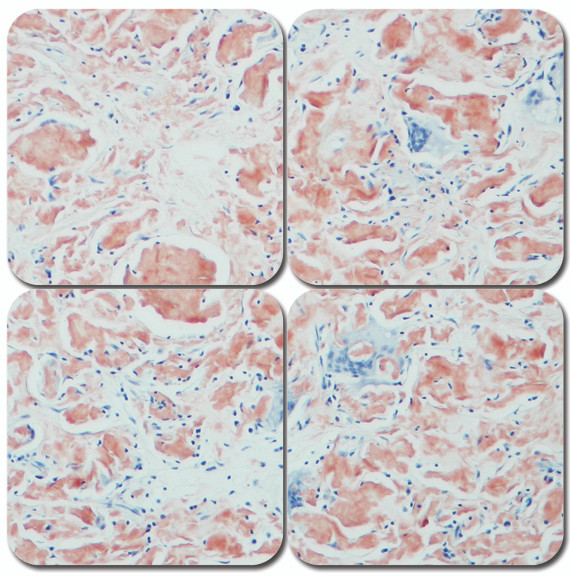 Alkaline Congo Red Amyloid Stain Kit - MasterTech