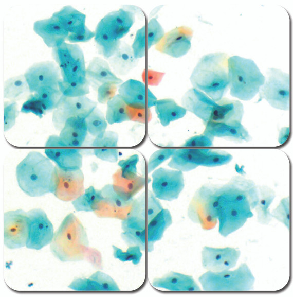 Papanicolaou, Modified Stain Kit