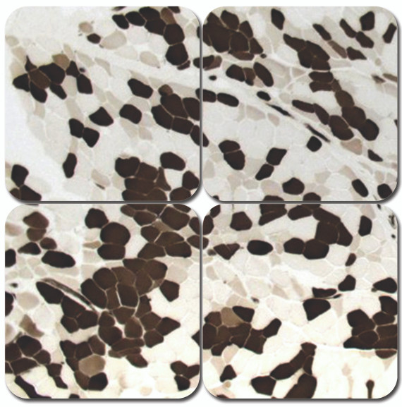 ATPase, Myofibrillar Stain Kit