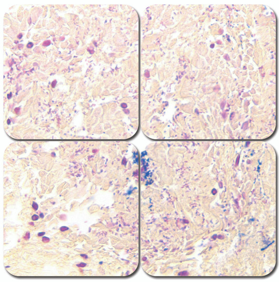 McDonald's Gram Stain Kit