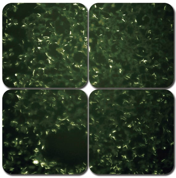 AFB Modified Truant's Fluorescent Kit, 100mL