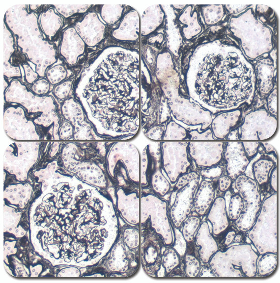 Jones Basement Membrane Reticulum Kit