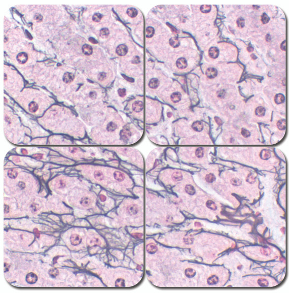 Reticulum Stain Kit, Chandler's Precision