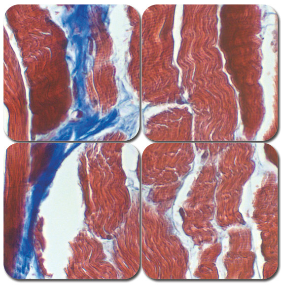 Trichrome Stain Kit - Masson's 2000