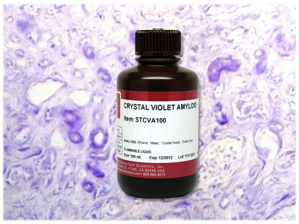 Crystal Violet Amyloid Stain