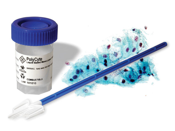 PolyCyte Cytology 20mL Prefills, 96/case
