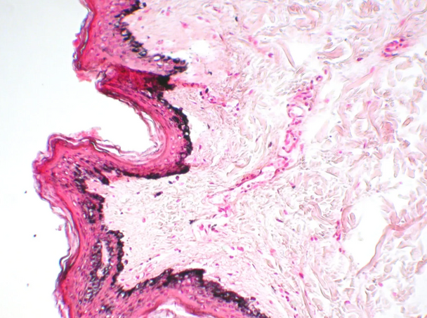 StatLab HCS Melanin Control Slides, adhesive slide. 100 slides / box