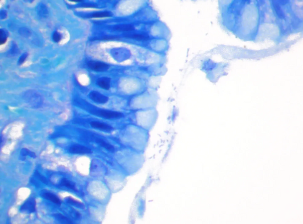 StatLab HCS H. Pylori Control Slides, adhesive slide