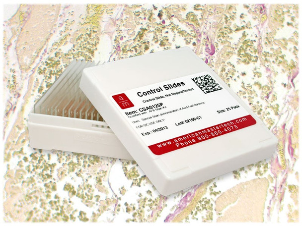 StatLab Bile Control Slides, adhesive slide. 25 slides / box