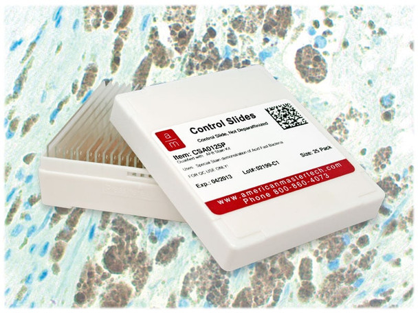 Melanoma S-100 Controls/25