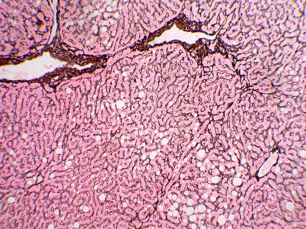 Reticulum Adhesion Slides