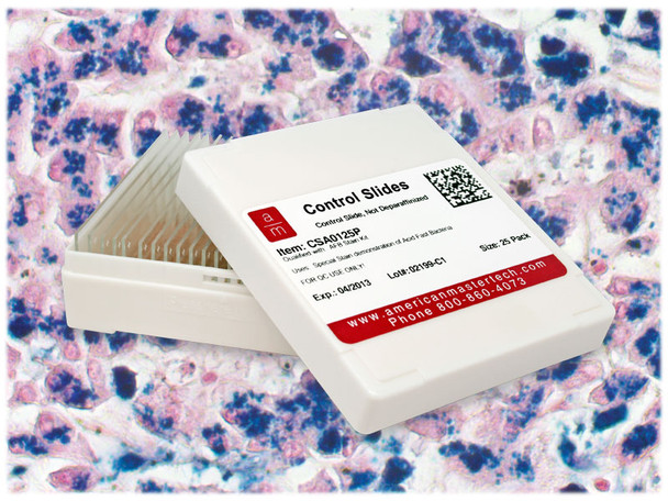 Ferric Iron Controls/25