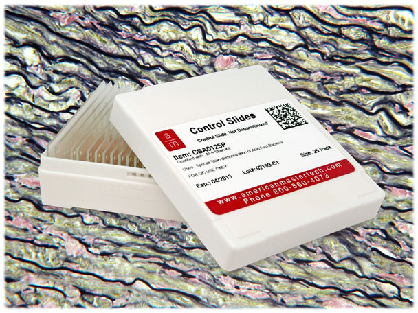 StatLab Aorta Control Slides, adhesive slide. 25 slides / box