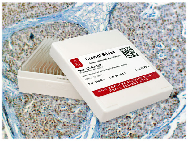 Breast Carcinoma, PR+ Controls