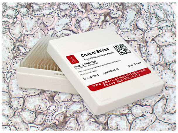 StatLab Kidney Control Slides, adhesive slide. 25 slides / box