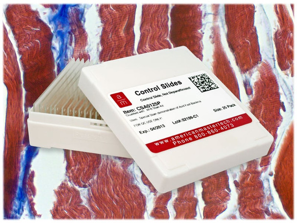 Trichrome Controls/25