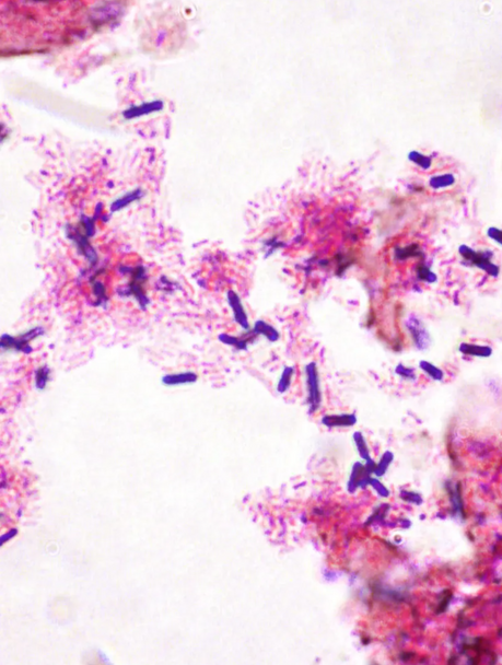 StatLab HCS Gram Control Slides, adhesive slide