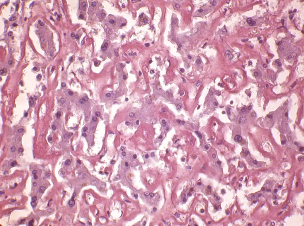 StatLab HCS Amyloid Control Slides, adhesive slide