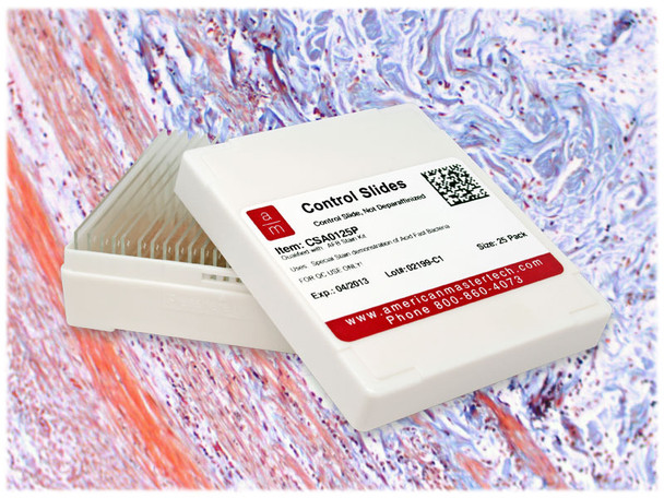 StatLab Appendix Control Slides, adhesive slide. 25 slides / box
