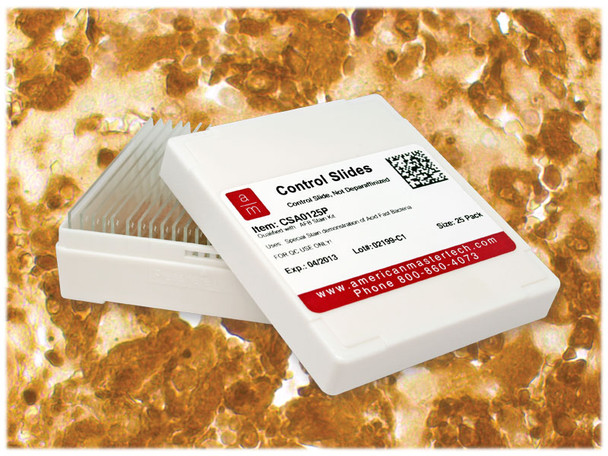 Liver (AFP) IHC Control Slides