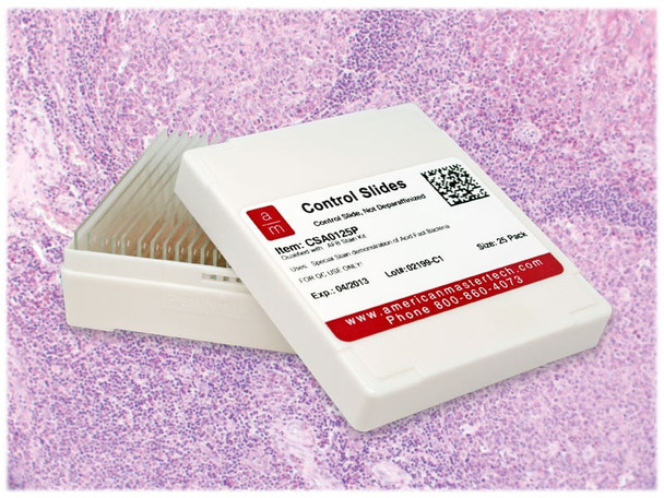 Tonsil IHC Control Slides